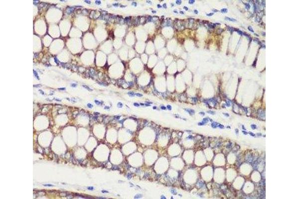 TOMM20 antibody