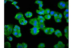 Immunofluorescence staining of HepG2 cells with ABIN7145438 at 1:66, counter-stained with DAPI. (ADRBK2 antibody  (AA 343-480))