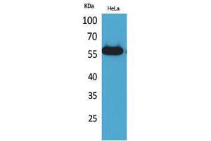 Western Blotting (WB) image for anti-Amylase (AMY) (N-Term) antibody (ABIN3178195) (Amylase antibody  (N-Term))