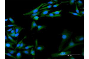 Immunofluorescence of purified MaxPab antibody to PPIA on HeLa cell. (PPIA antibody  (AA 1-165))
