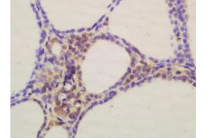 Tissue/cell: human thyroid gland, 4% Paraformaldehyde-fixed and paraffin-embeddedAntigen retrieval: citrate buffer (0. (GFRA4 antibody  (AA 51-150))