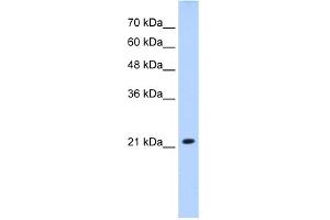 WB Suggested Anti-SLC25A14 Antibody Titration:  2. (SLC25A14 antibody  (N-Term))