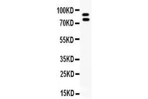Western blot analysis of MMP-9 expression in NRK whole cell lysates ( Lane 1). (MMP 9 antibody  (C-Term))