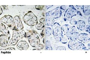 Immunohistochemistry analysis of paraffin-embedded human placenta tissue using MT-ND1 polyclonal antibody .