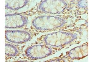 Immunohistochemistry of paraffin-embedded human colon tissue using ABIN7174493 at dilution of 1:100 (UBE2V2 antibody  (AA 1-145))