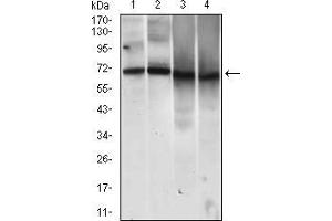 Western Blotting (WB) image for anti-Melanoma Cell Adhesion Molecule (MCAM) (AA 84-189) antibody (ABIN1724844)