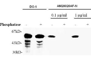 Western Blotting (WB) image for anti-Tumor Protein P53 (TP53) (AA 378-393), (pSer392) antibody (ABIN487475) (p53 antibody  (pSer392))