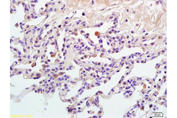 GAB2 antibody  (pTyr452)