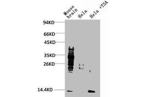 Western blot analysis of 1) Mouse Brain Tissue, 2) Hela, 3) Hela+TSA Treated using Acetyl Lysine Monoclonal Antibody. (Acetylated Lysine antibody)