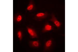 Immunofluorescent analysis of AMPK beta 1 staining in HeLa cells. (PRKAB1 antibody  (N-Term))