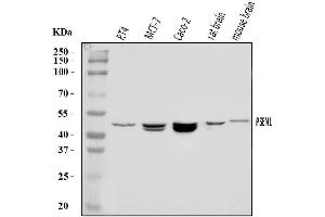 Western blot analysis of Presenilin 1/PS-1/PSEN1 using anti-Presenilin 1/PS-1/PSEN1 antibody (ABIN7599542).