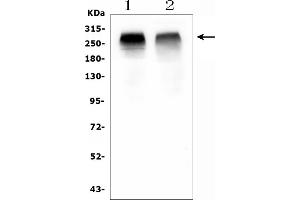 Western blot analysis of ACACB using anti-ACACB antibody (ABIN7602757).