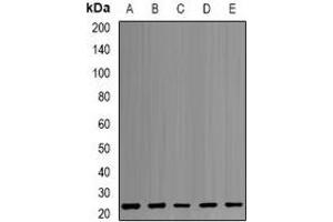 Western blot analysis of PSMB1 expression in MCF7 (A), HepG2 (B), K562 (C), PC3 (D), mouse liver (E) whole cell lysates. (PSMB1 antibody)