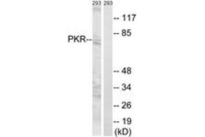 Western blot analysis of extracts from 293 cells, using PKR (Ab-258) Antibody. (EIF2AK2 antibody  (AA 226-275))