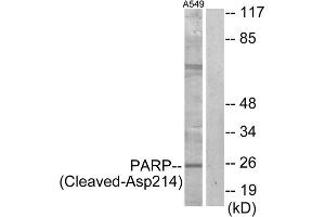 Western blot analysis of extracts from A549 cells, treated with etoposide (25uM, 24hours), using PARP (Cleaved-Asp214) antibody. (PARP1 antibody  (Cleaved-Asp214))