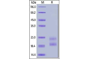 Biotinylated Human IL17A, His,Avitag on  under reducing (R) condition. (Interleukin 17a Protein (AA 24-155) (His tag,AVI tag,Biotin))