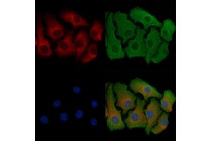 ABIN6257471 and ABIN6274750 staining Hela cells by IF/ICC. (RPS18 antibody  (C-Term))