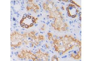 IHC-P analysis of kidney tissue, with DAB staining. (PTPRA antibody  (AA 624-800))