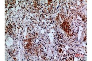 Immunohistochemistry (IHC) analysis of paraffin-embedded Human Lung, antibody was diluted at 1:100. (APAF1 antibody  (Internal Region))