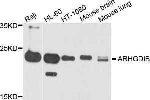 Western blot analysis of extracts of various cell lines, using ARHGDIB antibody (ABIN5971929) at 1/1000 dilution. (ARHGDIB antibody)