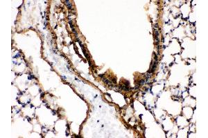IHC(P): Mouse Lung Tissue (MAP2K7 antibody  (N-Term))