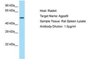 Image no. 1 for anti-1-Acylglycerol-3-Phosphate O-Acyltransferase 9 (AGPAT9) (AA 251-300) antibody (ABIN6749916) (AGPAT9 antibody  (AA 251-300))
