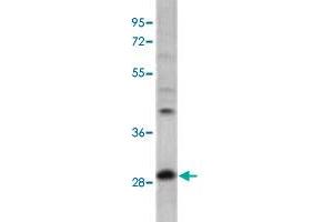 Western blot analysis of mouse cerebellum tissue lysates with PPT1 polyclonal antibody .
