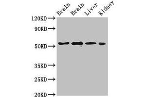 Western Blot Positive WB detected in: Rat brain tissue, Mouse brain tissue, Mouse liver tissue, Mouse kidney tissue All lanes: PPP2R2A antibody at 3 μg/mL Secondary Goat polyclonal to rabbit IgG at 1/50000 dilution Predicted band size: 52, 53 kDa Observed band size: 52 kDa (PPP2R2A antibody  (Regulatory Subunit B))