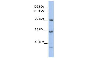 TPCN1 antibody used at 1 ug/ml to detect target protein. (TPCN1 antibody  (N-Term))