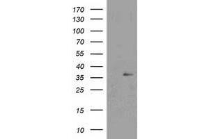 Western Blotting (WB) image for anti-Nudix (Nucleoside Diphosphate Linked Moiety X)-Type Motif 6 (NUDT6) antibody (ABIN1499867) (NUDT6 antibody)