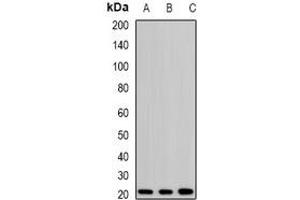 Western blot analysis of H-Ras expression in SKOV3 (A), mouse kidney (B), rat brain (C) whole cell lysates. (HRAS antibody)
