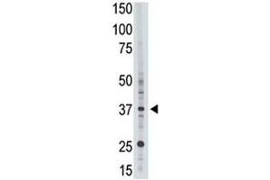 EPR1 antibody used in western blot to detect EPR1 in HL-60 cell lysate (EPR1 antibody  (AA 308-337))