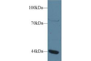 Western blot analysis of Human Jurkat cell lysate, using Human GTF3A Antibody (1 µg/ml) and HRP-conjugated Goat Anti-Rabbit antibody ( (GTF3A antibody  (AA 71-365))