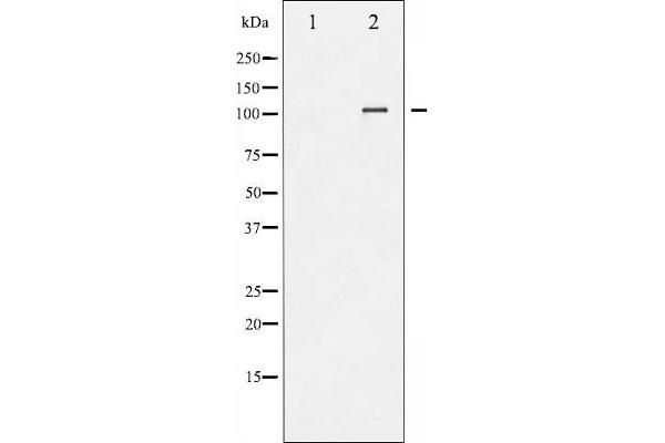 NFATC3 antibody  (pSer165)