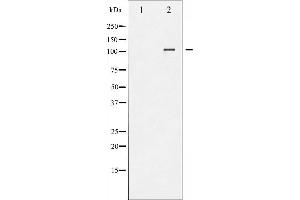 Western blot analysis of NFAT4 phosphorylation expression in HeLa whole cell lysates,The lane on the left is treated with the antigen-specific peptide.