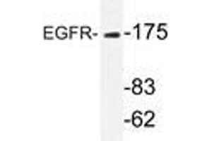 Western blot analyzes of EGFR antibody in extracts from HeLa cells. (EGFR antibody)