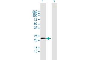 Western Blot analysis of MYL5 expression in transfected 293T cell line by MYL5 MaxPab polyclonal antibody. (MYL5 antibody  (AA 1-173))