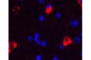 Immunofluorescence analysis of Mouse brain tissue using MAP2 Monoclonal Antibody at dilution of 1:200. (MAP2 antibody)