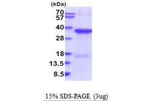 SDS-PAGE (SDS) image for MHC Class I Polypeptide-Related Sequence A (MICA) (AA 24-297) protein (His tag) (ABIN7280944)