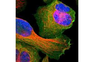 Immunofluorescence of U-2 OS cell line with SNAP23 polyclonal antibody  shows positivity in plasma membrane.