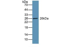 Western blot analysis of recombinant Rat RBP3. (RBP3 antibody  (AA 1027-1229))