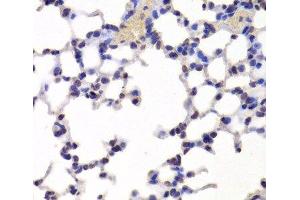 Immunohistochemistry of paraffin-embedded Mouse lung using INTS6 Polyclonal Antibody at dilution of 1:100 (40x lens). (INTS6 antibody)