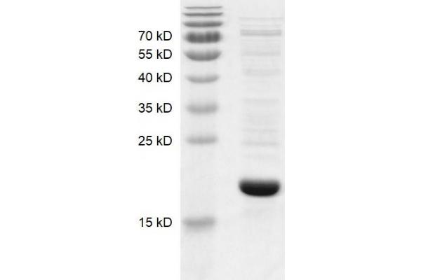 BRD1 Protein (AA 556-688) (His tag,DYKDDDDK Tag)