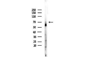 anti-Phosphatidylinositol Binding clathrin Assembly Protein (PICALM) (C-Term) antibody
