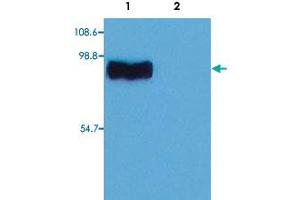 Western Blotting analysis (non-reducing conditions) of whole cell lysate of RBL (rat basophilic leukemia cell line). (STIM1 antibody  (C-Term))