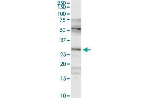 FHL2 MaxPab rabbit polyclonal antibody. (FHL2 antibody  (AA 1-279))