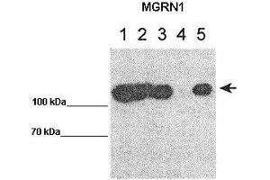 WB Suggested Anti-MGRN1 Antibody    Positive Control:  Lane 1: 10ug MGRN1-GFP transfected HEK293T Lane 2: 10ug mut1MGRN1-GFP transfected HEK293T Lane 3: 10ug mut1MGRN2-GFP transfected HEK293T Lane 4: 10ug GFP transfected HEK293T Lane 5: 10ug IP for GFP using lysate from lane 1   Primary Antibody Dilution :   1:1000   Secondary Antibody :  Goat anti rabbit-HRP   Secondry Antibody Dilution :   1:50,000  Submitted by:  Teresa Gunn, McLaughin Research Institute MGRN1 is supported by BioGPS gene expression data to be expressed in HEK293T (Mahogunin RING Finger Protein 1 antibody  (Middle Region))