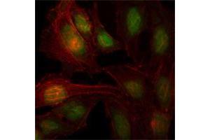 Immunofluorescence analysis of Hela cells using ZBTB7B mouse mAb (green).