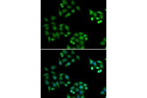 Immunofluorescence analysis of HeLa cell using NSFL1C antibody.