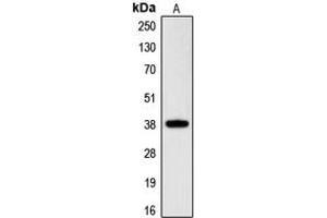 Western blot analysis of RNF197 expression in HeLa (A) whole cell lysates. (CGR19 antibody  (C-Term))